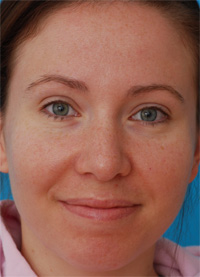 Before Image