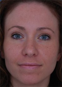 After Image