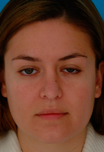 After Image