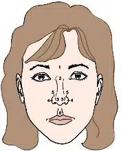 rhinoplasty sewell nj
