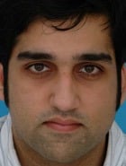 Before Image Asian Rhinoplasty Before & After New Jersey